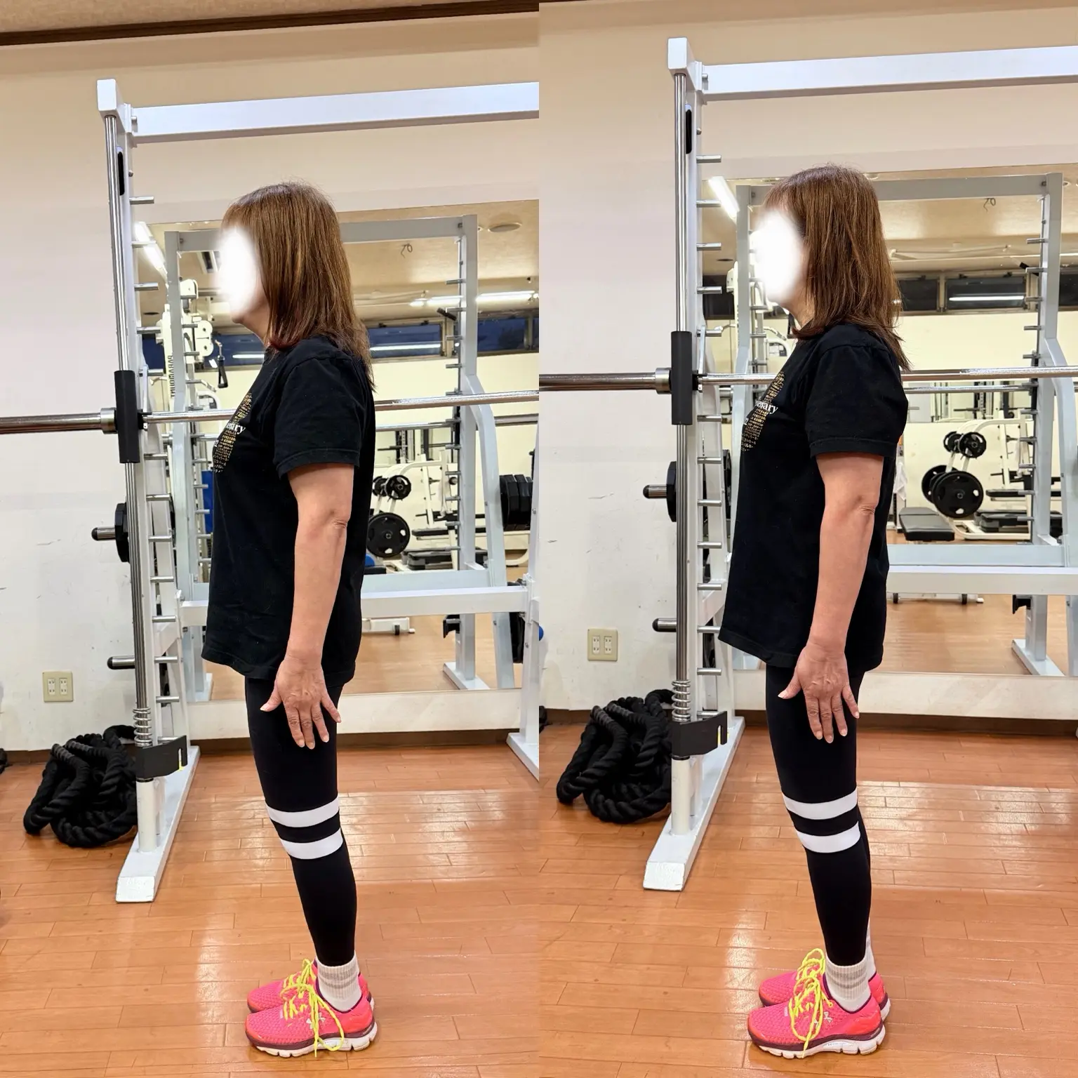 60代女性の姿勢確認前後における立ち姿の変化